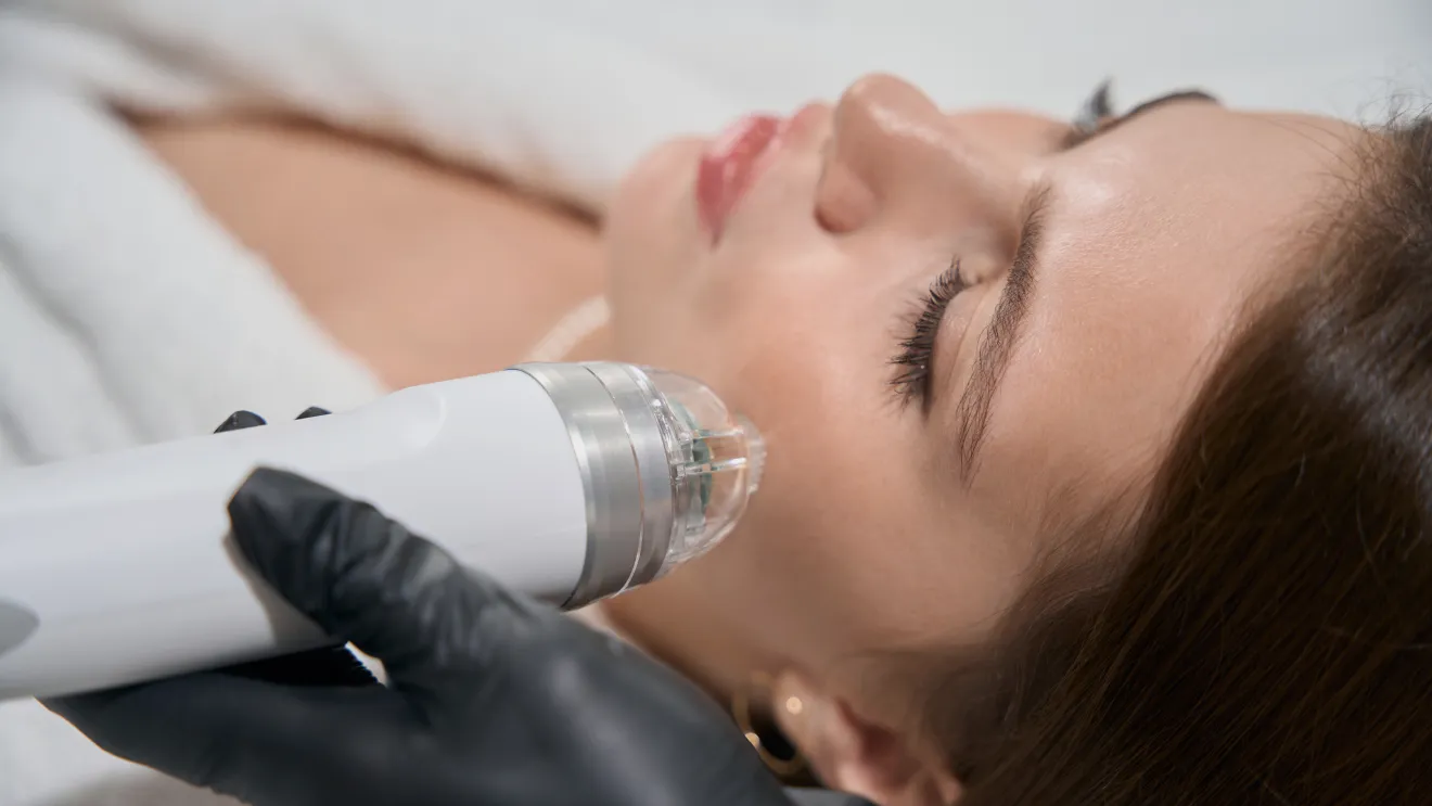 woman getting facial treatment, microneedling