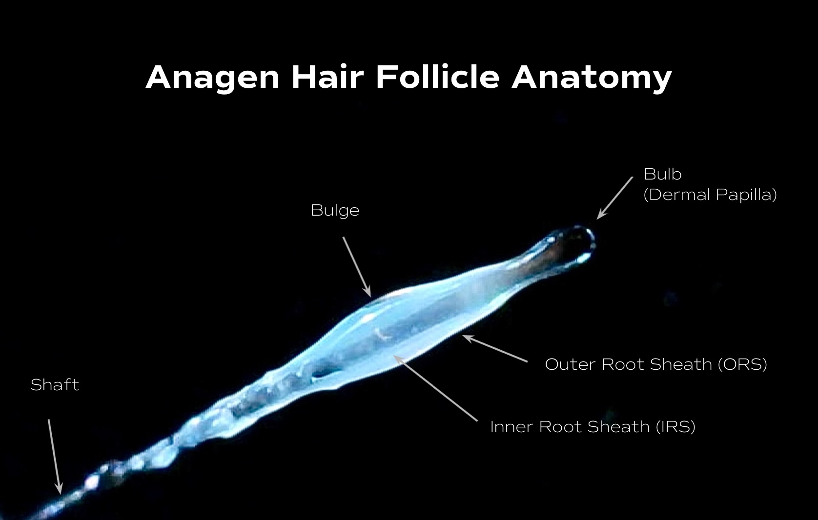 hair follicle anatomy