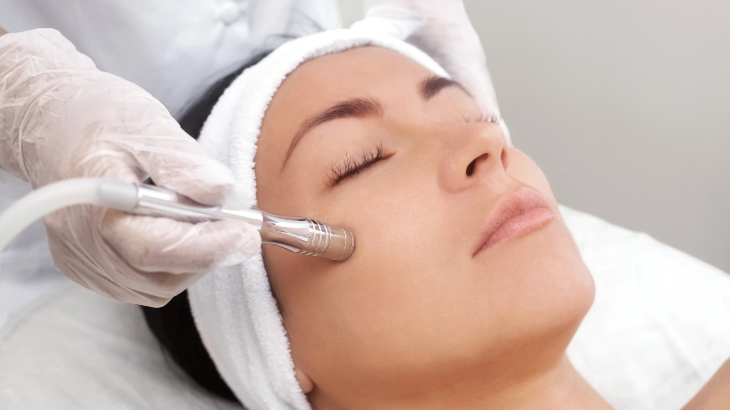 microneedling treatment